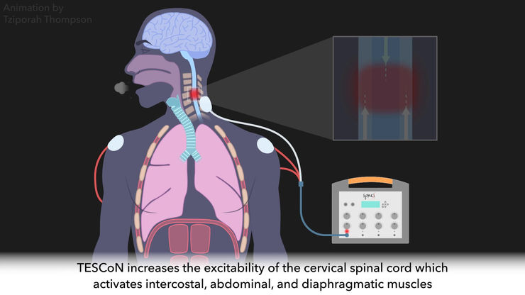 Cervical Stimulation for Improved Breathing